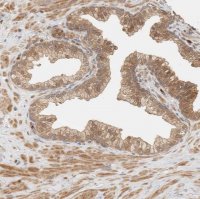 Anti-ADSS antibody produced in rabbit 
