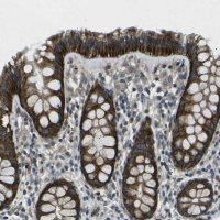 Anti-AFAP1 antibody produced in rabbit 