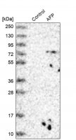 Anti-AFP antibody produced in rabbit 