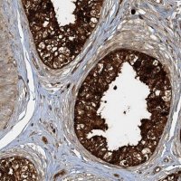 Anti-AGA antibody produced in rabbit 