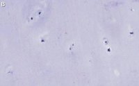 Anti-Aggrecan Antibody, clone 4B10 ZooMAb Rabbit Monoclonal 
