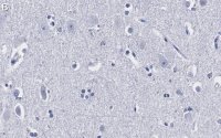 Anti-Ago2 Antibody, clone 2H10 ZooMAb Rabbit Monoclonal 
