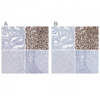 Anti-AGXT antibody produced in rabbit 