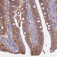 Anti-AHCYL1 antibody produced in rabbit HPA042589-100UL