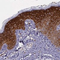 Anti-AHNAK2 antibody produced in rabbit 