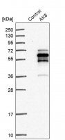 Anti-AK8 antibody produced in rabbit 