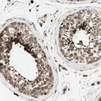 Anti-AKAP1 antibody produced in rabbit 
