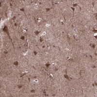 Anti-AKAP5 antibody produced in rabbit 