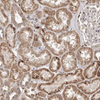 Anti-AKAP7 antibody produced in rabbit 