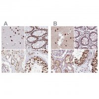 Anti-AKAP8L antibody produced in rabbit 