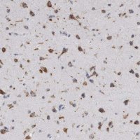 Anti-AKAP9 antibody produced in rabbit 
