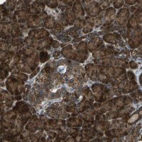 Anti-AKR1A1 antibody produced in rabbit 