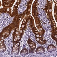 Anti-AKR1B10 antibody produced in rabbit 
