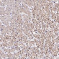 Anti-AKR1D1 antibody produced in rabbit HPA057002-100UL