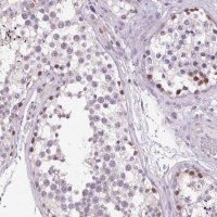 Anti-AKR1E2 antibody produced in rabbit 