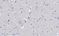 Anti-Akt Antibody, PH Domain Antibody, clone SKB1 ZooMAb Mouse Monoclonal 