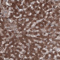 Anti-ALDH1A1 antibody produced in rabbit 