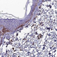 Anti-ALDH3B2 antibody produced in rabbit 