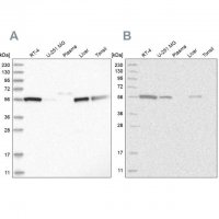 Anti-ALDH5A1 antibody produced in rabbit 