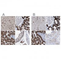 Anti-ALDH6A1 antibody produced in rabbit 