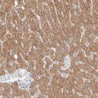 Anti-ALDH7A1 antibody produced in rabbit 