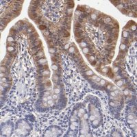 Anti-ALDOB antibody produced in rabbit HPA002198-100UL