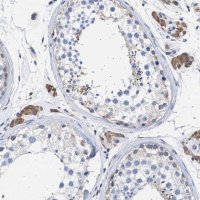 Anti-ALDOC antibody produced in rabbit 