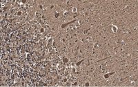 Anti-Aldolase C Antibody, clone 3B18, ZooMAb Rabbit Monoclonal 
