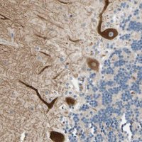 Anti-ALKBH3 antibody produced in rabbit 