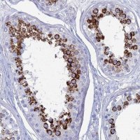 Anti-ALMS1 antibody produced in rabbit 