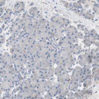 Anti-ALPL antibody produced in rabbit 