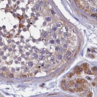 Anti-AMDHD2 antibody produced in rabbit 