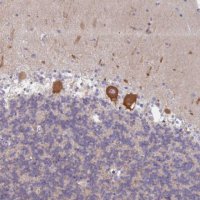 Anti-AMPD2 antibody produced in rabbit 