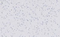 Anti-Amyloid 42/40 Antibody, clone W0-2 ZooMAb Mouse Monoclonal 