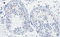 Anti-Androgen Receptor Antibody, clone 3K11 , ZooMAb Rabbit Monoclonal 