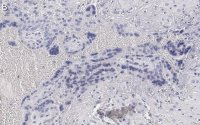 Anti-Angiopoietin-2 Antibody, clone 4L18 ZooMAb Rabbit Monoclonal 