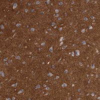Anti-ANK2 antibody produced in rabbit HPA008007-100UL