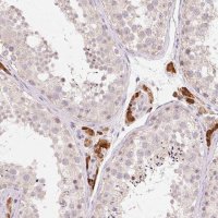 Anti-ANKRD31 antibody produced in rabbit 