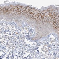 Anti-ANKRD35 antibody produced in rabbit 