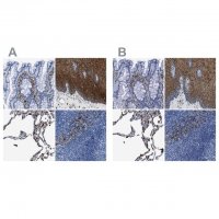Anti-ANXA1 antibody produced in rabbit 
