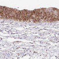 Anti-ANXA10 antibody produced in rabbit 