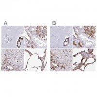 Anti-ANXA2 HPA046964-100UL