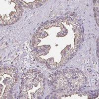 Anti-ANXA5 antibody produced in rabbit 