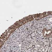 Anti-AOAH antibody produced in rabbit HPA026716-100UL