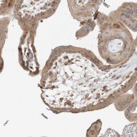 Anti-AP1AR antibody produced in rabbit 