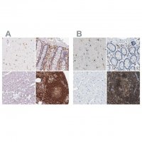 Anti-APBB1IP antibody produced in rabbit 