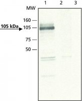 Anti-ApoER2 antibody produced in rabbit 