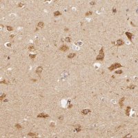 Anti-APP antibody produced in rabbit 