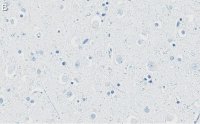 Anti-APP Antibody, clone 1F22 ZooMAb Rabbit Monoclonal 