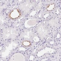 Anti-AQP2 antibody produced in rabbit 